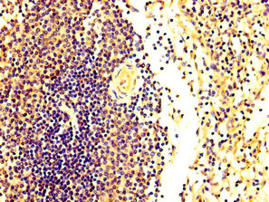 FASTKD2 Antibody - Immunohistochemistry image at a dilution of 1:300 and staining in paraffin-embedded human spleen tissue performed on a Leica BondTM system. After dewaxing and hydration, antigen retrieval was mediated by high pressure in a citrate buffer (pH 6.0) . Section was blocked with 10% normal goat serum 30min at RT. Then primary antibody (1% BSA) was incubated at 4 °C overnight. The primary is detected by a biotinylated secondary antibody and visualized using an HRP conjugated SP system.
