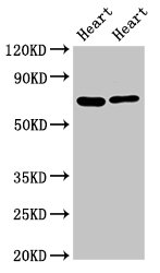 FASTKD2 Antibody - Positive Western Blot detected in Rat heart tisseu, Mouse heart tissue. All lanes: FASTKD2 antibody at 8 µg/ml Secondary Goat polyclonal to rabbit IgG at 1/50000 dilution. Predicted band size: 82, 75 KDa. Observed band size: 75 KDa