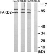 FASTKD2 Antibody - Western blot analysis of extracts from HepG2 cells, COLO cells and HUVEC cells, using FAKD2 antibody.