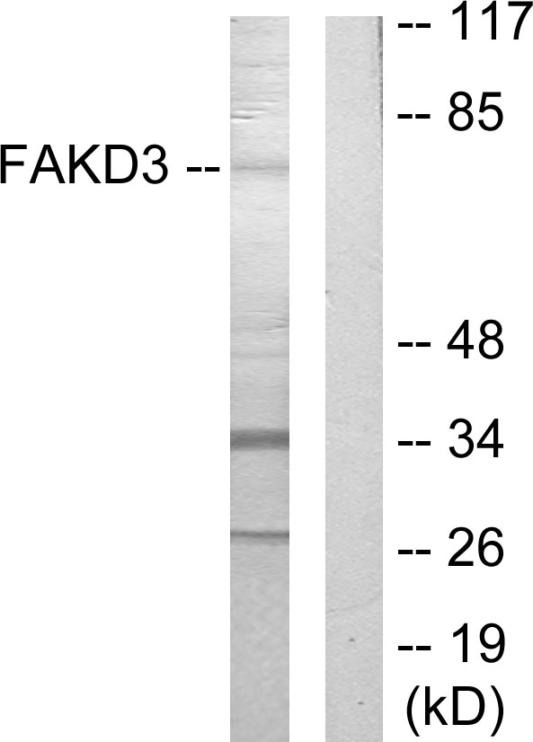 FASTKD3 Antibody - Western blot analysis of lysates from HepG2 cells, using FAKD3 Antibody. The lane on the right is blocked with the synthesized peptide.