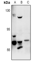 FASTKD3 Antibody - Western blot analysis of FASTKD3 expression in A549 (A), Hela (B), rat spleen (C) whole cell lysates.