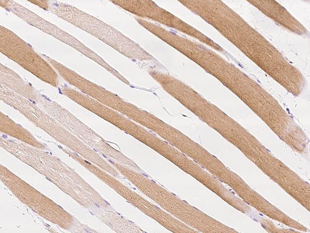 FASTKD3 Antibody - Immunochemical staining of human FASTKD3 in human skeletal muscle with rabbit polyclonal antibody at 1:100 dilution, formalin-fixed paraffin embedded sections.
