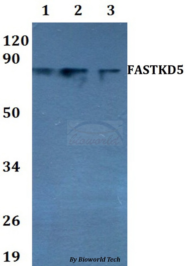FASTKD5 Antibody - Western blot of FASTKD5 antibody at 1:500 dilution. Lane 1: HEK293T whole cell lysate. Lane 2: sp2/0 whole cell lysate. Lane 3: PC12 whole cell lysate.