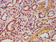 FASTKD5 Antibody - Immunohistochemistry image at a dilution of 1:400 and staining in paraffin-embedded human kidney tissue performed on a Leica BondTM system. After dewaxing and hydration, antigen retrieval was mediated by high pressure in a citrate buffer (pH 6.0) . Section was blocked with 10% normal goat serum 30min at RT. Then primary antibody (1% BSA) was incubated at 4 °C overnight. The primary is detected by a biotinylated secondary antibody and visualized using an HRP conjugated SP system.