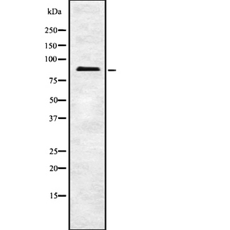 FASTKD5 Antibody - Western blot analysis FAKD5 using COLO205 whole cells lysates