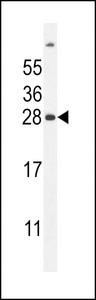 FAT10 / UBD Antibody - FAT10 Antibody western blot of mouse liver tissue lysates (35 ug/lane). The hFAT10 antibody detected the hFAT10 protein (arrow).