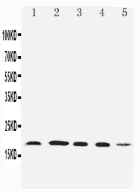 FAT10 / UBD Antibody - WB of FAT10 / UBD antibody. Lane 1: HELA Cell Lysate. Lane 2: SKOV Cell Lysate. Lane 3: MCF-7 Cell Lysate. Lane 4: A549 Cell Lysate. Lane 5: SMMC Cell Lysate.