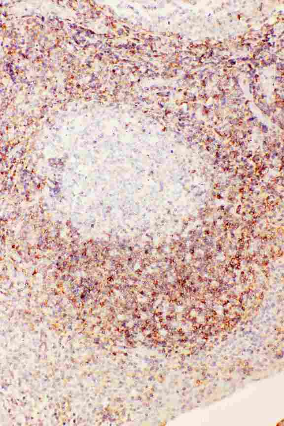 FAT10 / UBD Antibody - Anti-Diubiquitin antibody, IHC(P): Human Tonsil Tissue