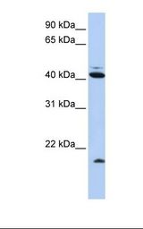 FAT10 / UBD Antibody - HepG2 cell lysate. Antibody concentration: 1.0 ug/ml. Gel concentration: 12%.  This image was taken for the unconjugated form of this product. Other forms have not been tested.