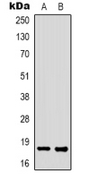 FAT10 / UBD Antibody - Western blot analysis of FAT10 expression in K562 (A); HEK293T (B) whole cell lysates.