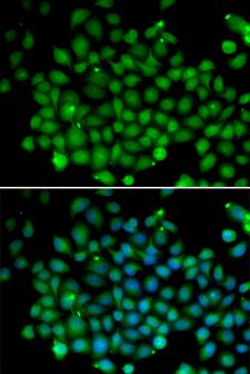 FAT10 / UBD Antibody - Immunofluorescence analysis of A549 cells.