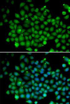 FAT10 / UBD Antibody - Immunofluorescence analysis of A549 cells using UBD antibody. Blue: DAPI for nuclear staining.