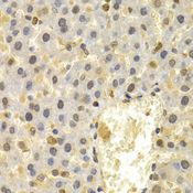 FAT10 / UBD Antibody - Immunohistochemistry of paraffin-embedded rat liver using UBD antibody at dilution of 1:200 (40x lens).