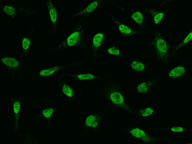 FAT10 / UBD Antibody - Immunofluorescence staining of UBD in HeLa cells. Cells were fixed with 4% PFA, permeabilzed with 0.1% Triton X-100 in PBS, blocked with 10% serum, and incubated with rabbit anti-human UBD polyclonal antibody (dilution ratio 1:1000) at 4°C overnight. Then cells were stained with the Alexa Fluor 488-conjugated Goat Anti-rabbit IgG secondary antibody (green). Positive staining was localized to Nucleus.
