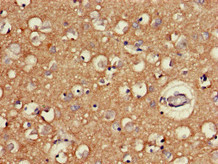 FAT3 Antibody - Immunohistochemistry image of paraffin-embedded human brain tissue at a dilution of 1:100