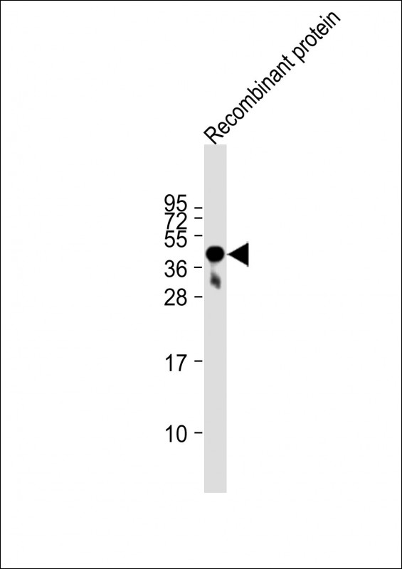 FAT4 Antibody - Anti-FAT4 Antibody at 1:2000 dilution + Recombinant protein at 20 ng per lane. Secondary Goat Anti-mouse IgG, (H+L), Peroxidase conjugated at 1/10000 dilution. Predicted band size: 543 kDa Blocking/Dilution buffer: 5% NFDM/TBST.