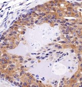 FAT4 Antibody - Immunohistochemistry: FAT4 Antibody - IHC of FAT4 in mouse prostate cancer using DAB with hematoxylin counterstain.  This image was taken for the unconjugated form of this product. Other forms have not been tested.