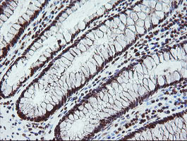 FATE1 Antibody - IHC of paraffin-embedded Human colon tissue using anti-FATE1 mouse monoclonal antibody.