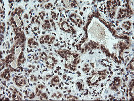 FATE1 Antibody - IHC of paraffin-embedded Human breast tissue using anti-FATE1 mouse monoclonal antibody.