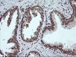 FATE1 Antibody - IHC of paraffin-embedded Human prostate tissue using anti-FATE1 mouse monoclonal antibody.
