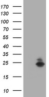 FATE1 Antibody - HEK293T cells were transfected with the pCMV6-ENTRY control (Left lane) or pCMV6-ENTRY FATE1 (Right lane) cDNA for 48 hrs and lysed. Equivalent amounts of cell lysates (5 ug per lane) were separated by SDS-PAGE and immunoblotted with anti-FATE1.