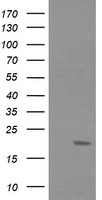 FATE1 Antibody - HEK293T cells were transfected with the pCMV6-ENTRY control (Left lane) or pCMV6-ENTRY FATE1 (Right lane) cDNA for 48 hrs and lysed. Equivalent amounts of cell lysates (5 ug per lane) were separated by SDS-PAGE and immunoblotted with anti-FATE1.