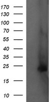 FATE1 Antibody - HEK293T cells were transfected with the pCMV6-ENTRY control (Left lane) or pCMV6-ENTRY FATE1 (Right lane) cDNA for 48 hrs and lysed. Equivalent amounts of cell lysates (5 ug per lane) were separated by SDS-PAGE and immunoblotted with anti-FATE1.