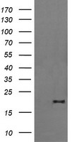 FATE1 Antibody - HEK293T cells were transfected with the pCMV6-ENTRY control (Left lane) or pCMV6-ENTRY FATE1 (Right lane) cDNA for 48 hrs and lysed. Equivalent amounts of cell lysates (5 ug per lane) were separated by SDS-PAGE and immunoblotted with anti-FATE1.
