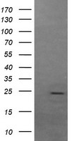 FATE1 Antibody - HEK293T cells were transfected with the pCMV6-ENTRY control. (Left lane) or pCMV6-ENTRY FATE1. (Right lane) cDNA for 48 hrs and lysed