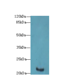 FATE1 Antibody - Western blot. All lanes: FATE1 antibody at 0.2 ug/ml+HL4- whole cell lysate Goat polyclonal to rabbit at 1:10000 dilution. Predicted band size: 21 kDa. Observed band size: 21 kDa.