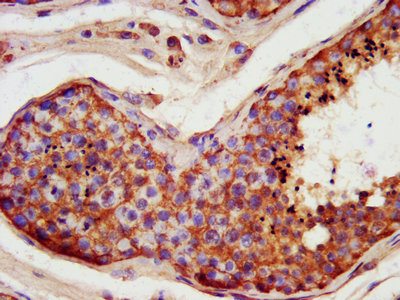 FATE1 Antibody - IHC image of FATE1 Antibody diluted at 1:400 and staining in paraffin-embedded human testis tissue performed on a Leica BondTM system. After dewaxing and hydration, antigen retrieval was mediated by high pressure in a citrate buffer (pH 6.0). Section was blocked with 10% normal goat serum 30min at RT. Then primary antibody (1% BSA) was incubated at 4°C overnight. The primary is detected by a biotinylated secondary antibody and visualized using an HRP conjugated SP system.