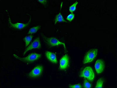 FATE1 Antibody - Immunofluorescent analysis of A549 cells using FATE1 Antibody at dilution of 1:100 and Alexa Fluor 488-congugated AffiniPure Goat Anti-Rabbit IgG(H+L)