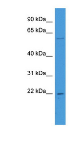 FATE1 Antibody - FATE1 antibody Western blot of Fetal Kidney lysate.  This image was taken for the unconjugated form of this product. Other forms have not been tested.