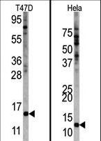 FAU / Fub1 Antibody - Western blot of anti-FUBI Center antibody in HeLa and T47D cell line lysates. FUBI Center(arrow) was detected using the purified antibody.