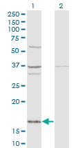 FAU / Fub1 Antibody - Western Blot analysis of FAU expression in transfected 293T cell line by FAU monoclonal antibody (M03), clone 3C10.Lane 1: FAU transfected lysate(14.4 KDa).Lane 2: Non-transfected lysate.