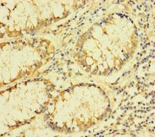 FAU / Fub1 Antibody - Immunohistochemistry of paraffin-embedded human colon cancer at dilution of 1:100