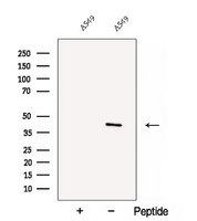 FAXDC2 / C5orf4 Antibody - Western blot analysis of extracts of A549 cells using C5orf4 antibody. The lane on the left was treated with blocking peptide.