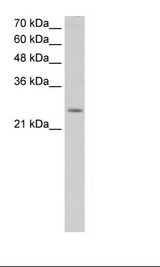 FAXDC2 / C5orf4 Antibody - HepG2 Cell Lysate.  This image was taken for the unconjugated form of this product. Other forms have not been tested.