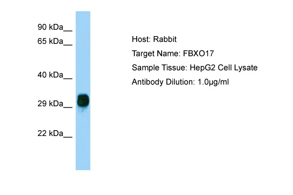 FBG4 / FBXO17 Antibody -  This image was taken for the unconjugated form of this product. Other forms have not been tested.