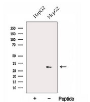 FBG4 / FBXO17 Antibody - Western blot analysis of extracts of HepG2 cells using FBXO17 antibody. The lane on the left was treated with blocking peptide.
