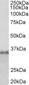 FBL / FIB / Fibrillarin Antibody - FBL antibody (1 ug/ml) staining of HEK293 lysate (35 ug protein in RIPA buffer). Primary incubation was 1 hour. Detected by chemiluminescence.