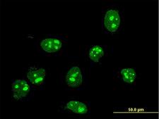 FBL / FIB / Fibrillarin Antibody - Immunofluorescence of monoclonal antibody to FBL on HeLa cell . [antibody concentration 10 ug/ml]