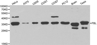 FBL / FIB / Fibrillarin Antibody - Western blot of FBL pAb in extracts from Hela, A375, U20S, COS1, COS7, PC12 cells and mouse brain, tesis tissues.