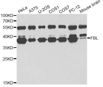 FBL / FIB / Fibrillarin Antibody - Western blot analysis of extracts of various cell lines, using FBL antibody at 1:1000 dilution. The secondary antibody used was an HRP Goat Anti-Rabbit IgG (H+L) at 1:10000 dilution. Lysates were loaded 25ug per lane and 3% nonfat dry milk in TBST was used for blocking.