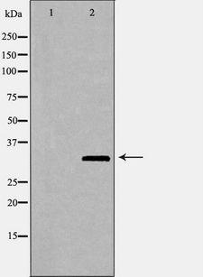 FBL / FIB / Fibrillarin Antibody - Western blot analysis of HeLa whole cells lysates using FBL antibody. The lane on the left is treated with the antigen-specific peptide.