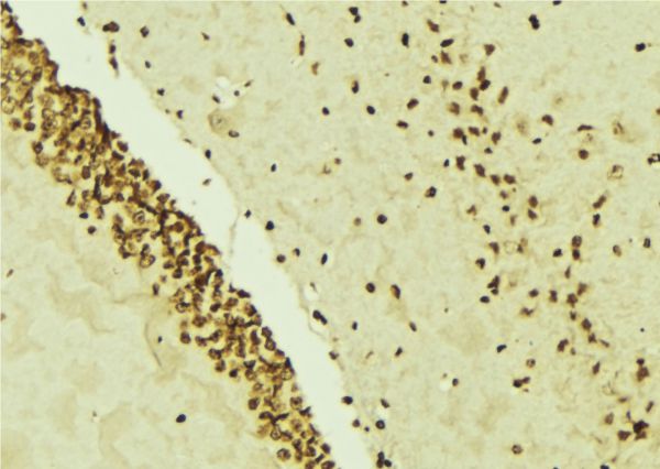 FBL / FIB / Fibrillarin Antibody - 1:100 staining mouse brain tissue by IHC-P. The sample was formaldehyde fixed and a heat mediated antigen retrieval step in citrate buffer was performed. The sample was then blocked and incubated with the antibody for 1.5 hours at 22°C. An HRP conjugated goat anti-rabbit antibody was used as the secondary.