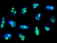 FBL / FIB / Fibrillarin Antibody - Immunofluorescence staining of FBL in HeLa cells. Cells were fixed with 4% PFA, permeabilzed with 0.3% Triton X-100 in PBS, blocked with 10% serum, and incubated with rabbit anti-Human FBL polyclonal antibody (dilution ratio 1:5000) at 4°C overnight. Then cells were stained with the Alexa Fluor 488-conjugated Goat Anti-rabbit IgG secondary antibody (green) and counterstained with DAPI (blue). Positive staining was localized to nucleus.