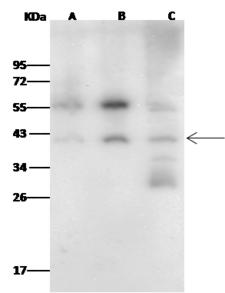 FBL / FIB / Fibrillarin Antibody - Anti-FBL rabbit polyclonal antibody at 1:500 dilution. Lane A: K562 whole cell lysate. Lane B: Jurkat whole cell lysate. Lane C: Hela whole cell lysate. Lysates/proteins at 30 ug per lane. Secondary: Goat Anti-Rabbit IgG (H+L)/HRP at 1/10000 dilution. Developed using the ECL technique. Performed under reducing conditions. Predicted band size: 34 kDa. Observed band size: 41 kDa. (We are unsure as to the identity of these extra bands.)