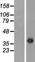 FBL / FIB / Fibrillarin Protein - Western validation with an anti-DDK antibody * L: Control HEK293 lysate R: Over-expression lysate