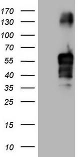 FBLIM1 / Migfilin Antibody - HEK293T cells were transfected with the pCMV6-ENTRY control. (Left lane) or pCMV6-ENTRY FBLIM1. (Right lane) cDNA for 48 hrs and lysed. Equivalent amounts of cell lysates. (5 ug per lane) were separated by SDS-PAGE and immunoblotted with anti-FBLIM1.